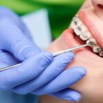 Cómo saber si mi tratamiento de ortodoncia es correcto